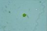 Haematococcus