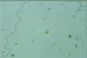 Oocystis