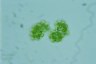 Botryococcus sudetica