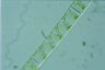 Spirogyra