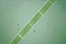 Spirogyra