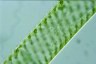 Spirogyra