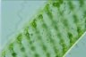 Spirogyra