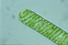 Spirogyra