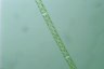 Spirogyra