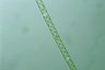 Spirogyra