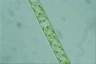 Spirogyra