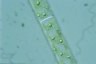 Spirogyra