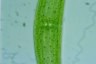 Closterium lunula