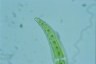 Closterium moniliferum