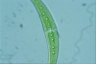 Closterium moniliferum