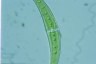 Closterium moniliferum