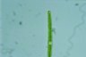 Closterium toxon