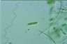 Cylindrocystis