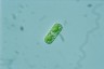 Cylindrocystis