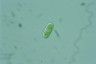 Cylindrocystis