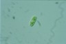 Cylindrocystis