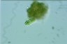 Cylindrocystis