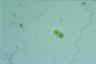 Cylindrocystis