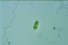 Cylindrocystis