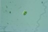 Cylindrocystis