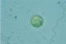 Acanthocystis turfacea