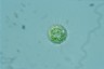 Acanthocystis turfacea