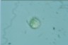 Acanthocystis turfacea