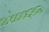 Spirogyra