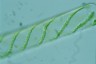 Spirogyra