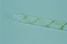 Spirogyra