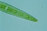 Closterium acerosum