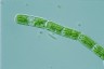 Cylindrocystis