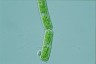 Cylindrocystis