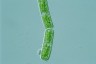 Cylindrocystis