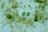 Chroococcus turgidus