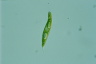 Euglena spirogyra