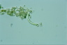 Ophiocytium parvulum