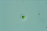 Gloeocystis