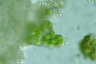 Apatococcus lobatus