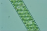 Spirogyra