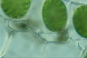 Spirogyra