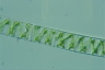 Spirogyra