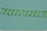 Spirogyra