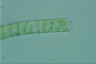 Spirogyra