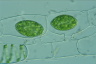 Spirogyra