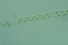 Spirogyra