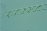 Spirogyra