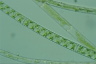 Spirogyra