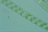 Spirogyra